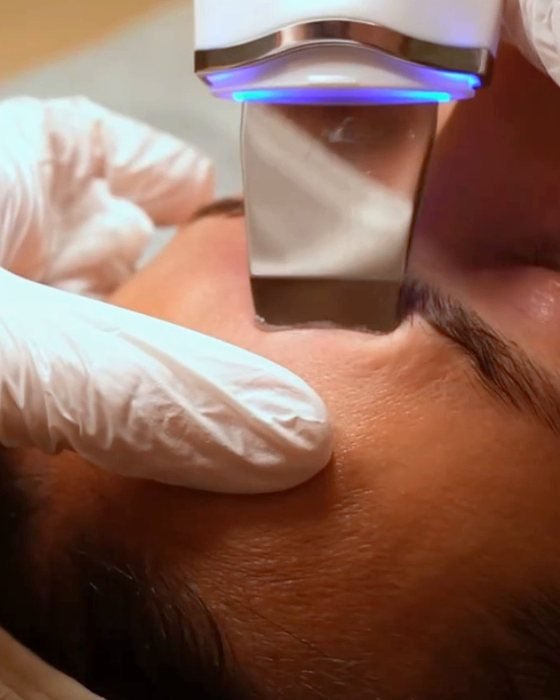 Hydra Facial